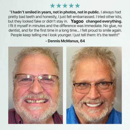 "🎁Ends Today: 70% OFF! ⏰Yagoo™ Medical Full Denture with Strong Suctiond🦷Obtain American Dental Association (ADA) Certification