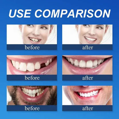 "🎁Ends Today: 70% OFF! ⏰Yagoo™ Medical Full Denture with Strong Suctiond🦷Obtain American Dental Association (ADA) Certification